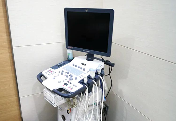 超音波診断装置